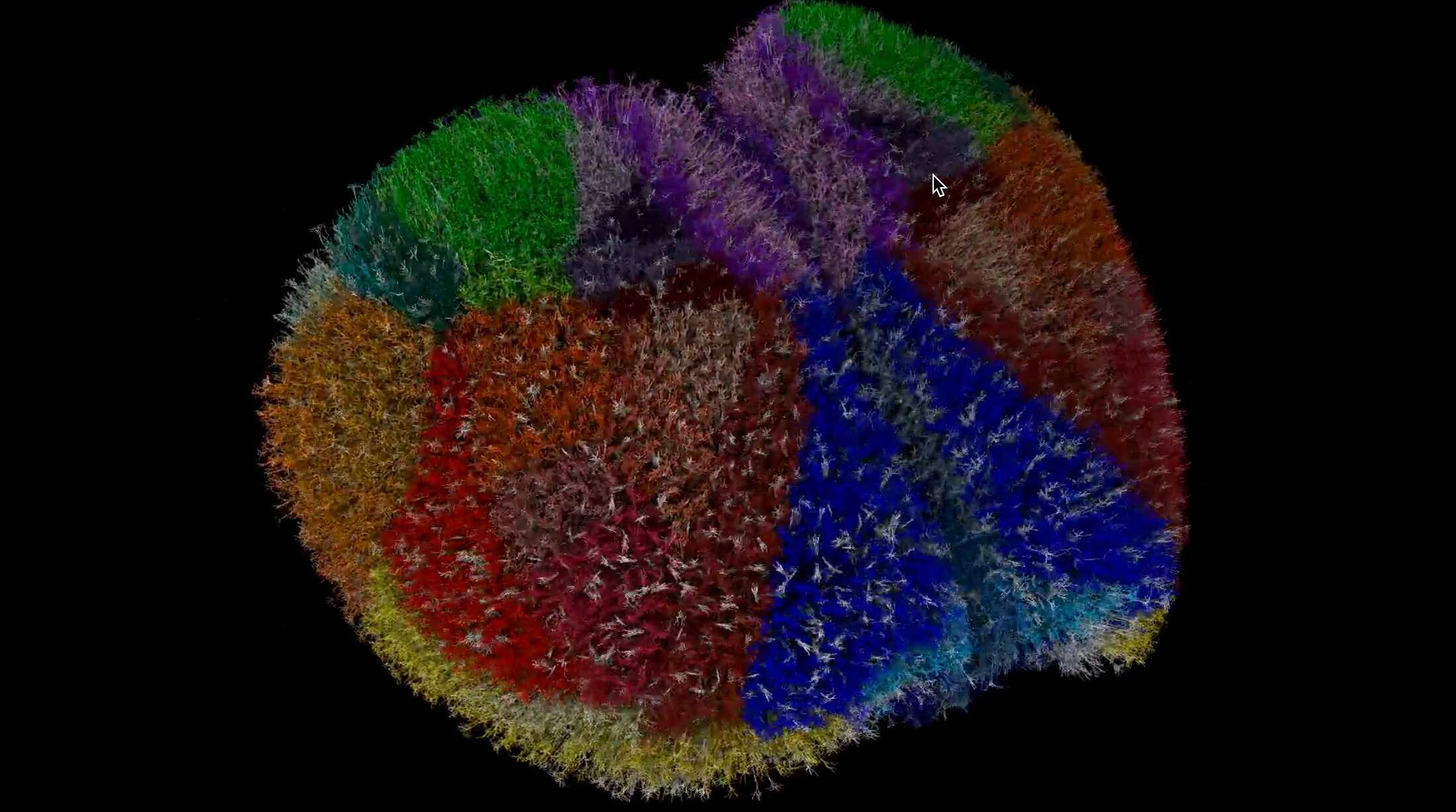 Simulação cerebral avança no estudo de Alzheimer e epilepsia